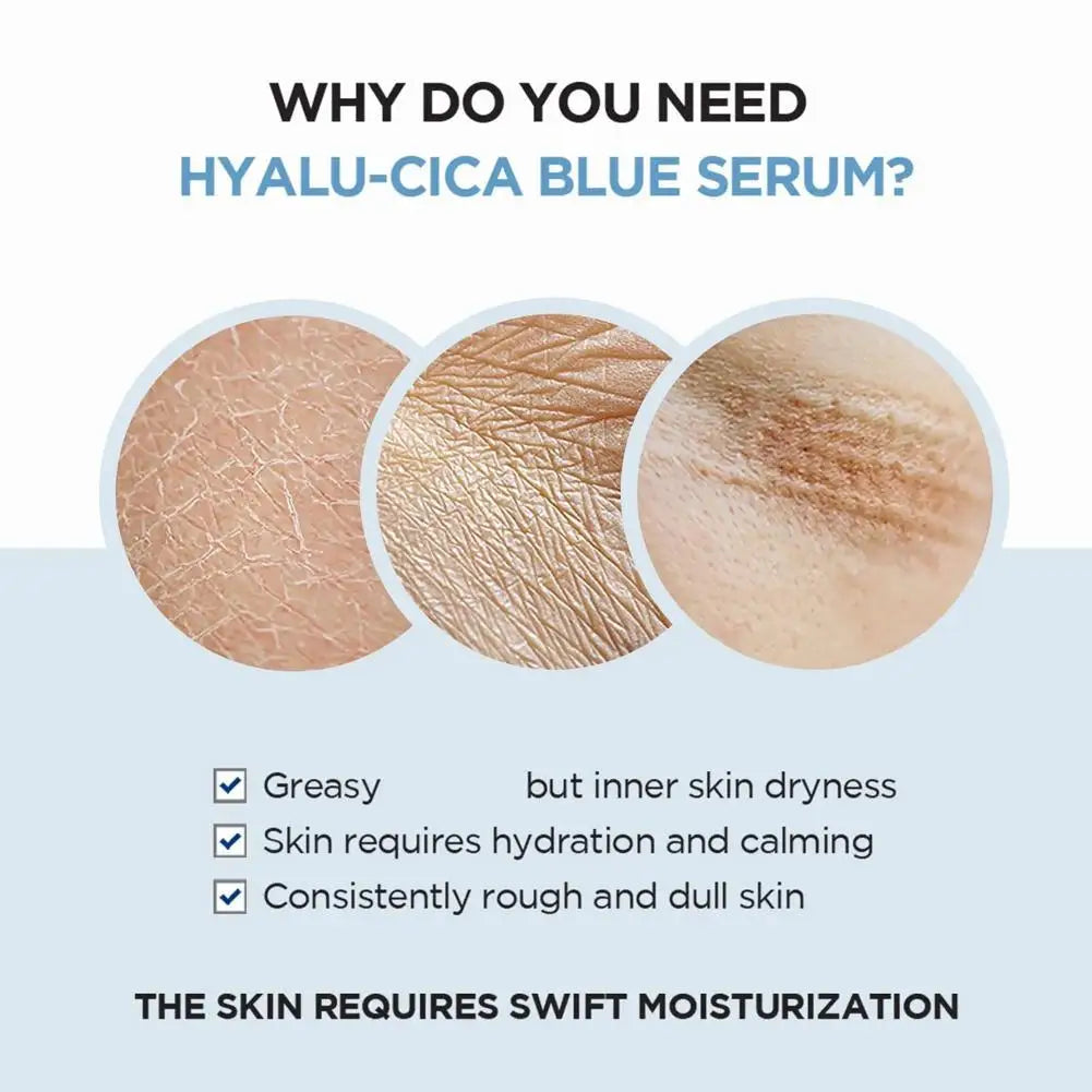 Hydra Cica Essence