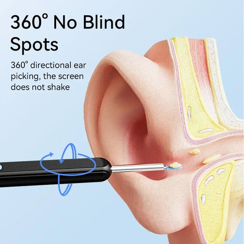ClearView Pro™ Ear Camera – See Inside Your Ear Safely